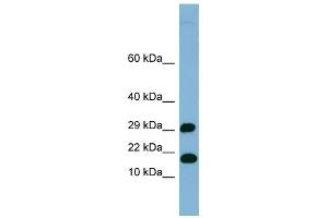 TRAPPC2L antibody used at 1 ug/ml to detect target protein. (TRAPPC2L 抗体  (N-Term))