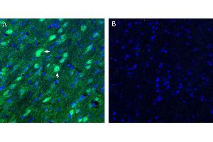 Free-floating frozen brain sections from a paraformaldehyde-perfused mouse were incubated with Anti-Neurokinin 2 Receptor (NK2R) Antibody (ABIN7043806, 1:200), followed by goat anti-rabbit secondary antibody conjugated to Alexa Fluor® 488 (green). (TACR2 抗体  (Intracellular, N-Term))