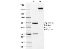 SDS-PAGE Analysis Purified Cytokeratin 10 Mouse Monoclonal Antibody (LH2). (Keratin 10 抗体)
