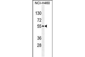 Western blot analysis in NCI-H460 cell line lysates (35ug/lane). (MIER2 抗体  (N-Term))