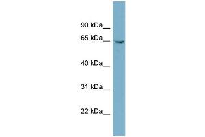 WB Suggested Anti-PGM3  Antibody Titration: 0. (Phosphoglucomutase 3 抗体  (N-Term))