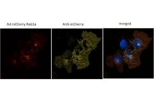 293 HEK cells transduced with Ad mCherry Rab1a and stained with anti-mCherry (mCherry 抗体)