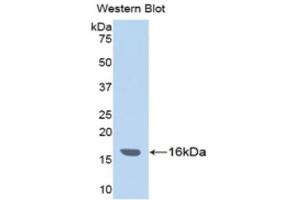 Western Blotting (WB) image for anti-Inter alpha Globulin Inhibitor H4 (ITIH4) (AA 29-157) antibody (ABIN1176673) (ITIH4 抗体  (AA 29-157))