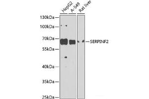 Western blot analysis of extracts of various cell lines using SERPINF2 Polyclonal Antibody at dilution of 1:1000. (alpha 2 Antiplasmin 抗体)