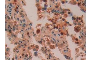 Detection of AZU in Human Lung Tissue using Polyclonal Antibody to Azurocidin (AZU) (Azurocidin 抗体  (AA 23-247))