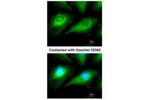 ICC/IF Image Immunofluorescence analysis of methanol-fixed HeLa, using OTUB1, antibody at 1:50 dilution. (OTUB1 抗体  (Center))