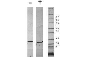SDS-PAGE of Human CD40 Ligand Recombinant Protein SDS-PAGE of Human CD40 Ligand Recombinant Protein.