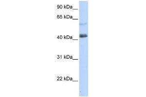 WB Suggested Anti-PRDM15 Antibody Titration:  0. (PRDM15 抗体  (C-Term))