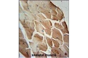 ACOT11 Antibody (C-term) (ABIN654089 and ABIN2843976) immunohistochemistry analysis in formalin fixed and paraffin embedded human skeletal muscle followed by peroxidase conjugation of the secondary antibody and DAB staining. (ACOT11 抗体  (C-Term))