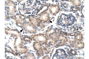 RGS20 antibody was used for immunohistochemistry at a concentration of 4-8 ug/ml to stain Epithelial cells of renal tubule (arrows) in Human Kidney. (RGS20 抗体  (Middle Region))