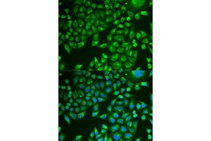 Immunofluorescence analysis of U2OS cell using PNLIP antibody. (PNLIP 抗体)