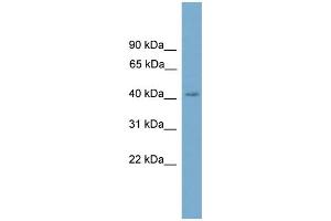 WB Suggested Anti-CXorf9 Antibody Titration: 0. (SASH3 抗体  (C-Term))