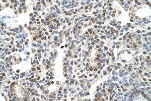 Image no. 1 for anti-Melanoma Antigen Family A, 8 (MAGEA8) (AA 51-100) antibody (ABIN6736631) (MAGEA8 抗体  (AA 51-100))