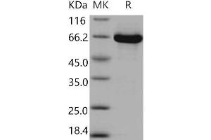 MEK1 Protein (GST tag,His tag)