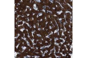 Immunohistochemical staining of human liver with CYP2C19 polyclonal antibody  shows strong cytoplasmic positivity in hepatocytes. (CYP2C9 抗体)
