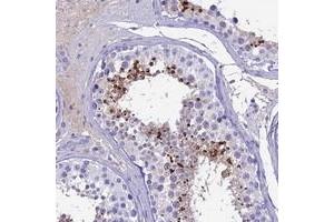 Immunohistochemical staining of human testis with SPACA4 polyclonal antibody  shows strong cytoplasmic positivity in spermatids. (SPACA4 抗体)