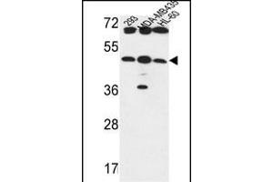 B3GNT5 Antibody (Center) (ABIN653601 and ABIN2842966) western blot analysis in 293,MDA-M,HL-60 cell line lysates (35 μg/lane). (B3GNT5 抗体  (AA 118-145))