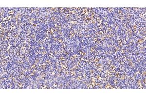 Immunohistochemistry (IHC) image for anti-Cathepsin S (CTSS) (AA 115-331) antibody (ABIN7434368)