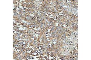 IHC analysis of ICAM1 using anti-ICAM1 antibody (ABIN5692991). (ICAM1 抗体  (AA 28-268))