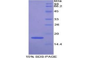 SDS-PAGE analysis of Mouse GPX4 Protein. (GPX4 蛋白)