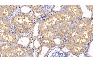 Detection of FZD4 in Human Kidney Tissue using Polyclonal Antibody to Frizzled Homolog 4 (FZD4) (FZD4 抗体  (AA 37-222))