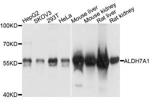 Western blot analysis of extracts of various cell lines, using ALDH7A1 antibody. (ALDH7A1 抗体  (AA 430-539))