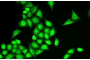 Immunofluorescence analysis of U2OS cells using RNF40 Polyclonal Antibody (RNF40 抗体)