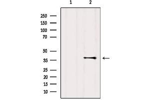 Western blot analysis of extracts from Mouse brain, using GPR119 Antibody. (G Protein-Coupled Receptor 119 抗体  (Internal Region))