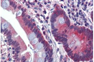 Immunohistochemistry (Paraffin-embedded Sections) (IHC (p)) image for anti-ATPase, H+ Transporting, Lysosomal V0 Subunit A2 (ATP6V0A2) (AA 72-121) antibody (ABIN6741595)
