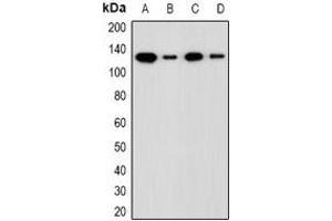 Western blot analysis of ADNP expression in LOVO (A), HCT116 (B), mouse liver (C), rat liver (D) whole cell lysates.