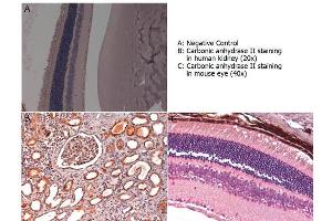 Immunohistochemistry with anti-carbonic anhydrase II antibody showing carbonic anhydrase II staining in nucleus and cytoplasm of proximal and distal tubules, bowman’s capsule and glomerular podocytes of human kidney (B) and in basal cells of retina of a mouse eye (C). (CA2 抗体)