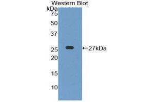 Western Blotting (WB) image for anti-Leukocyte Immunoglobulin-Like Receptor B3 (LILRB3) (AA 410-631) antibody (ABIN1859665) (LILRB3 抗体  (AA 410-631))