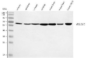 anti-Ribosomal L1 Domain Containing 1 (RSL1D1) (AA 62-452) antibody
