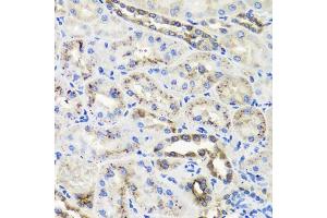 Immunohistochemistry of paraffin-embedded rat kidney using HSD11B2 antibody (ABIN5995471) at dilution of 1/100 (40x lens). (HSD11B2 抗体)