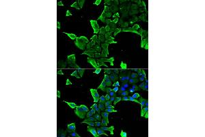 Immunofluorescence analysis of A549 cells using NCS1 antibody. (NCS1 抗体)