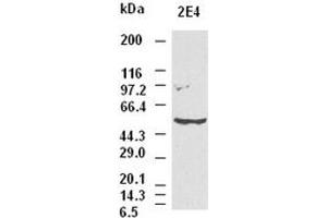 CK8 antibody (2E4) at 1:1000 dilution + Hela cell lysate (KRT8 抗体  (AA 91-381))