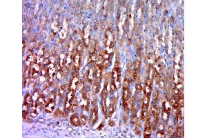 Paraformaldehyde-fixed, paraffin embedded rat stomach, Antigen retrieval by boiling in sodium citrate buffer (pH6. (Hexokinase 1 抗体  (AA 501-600))