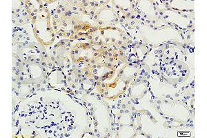 Formalin-fixed and paraffin embedded: rat kidney tissue labeled with Anti-PKCB Polyclonal Antibody, Unconjugated (ABIN727010) at 1:200, followed by conjugation to the secondary antibody and DAB staining (PKC beta 抗体  (AA 601-673))