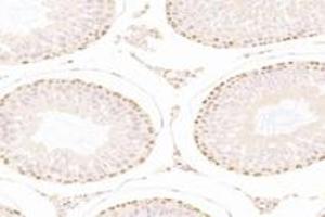 Immunohistochemistry (Paraffin-embedded Sections) (IHC (p)) image for anti-Zinc Finger Protein 746 (ZNF746) antibody (ABIN7076272)