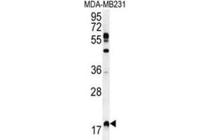 Western Blotting (WB) image for anti-Ras Homolog Enriched in Brain (RHEB) antibody (ABIN2996362) (RHEB 抗体)