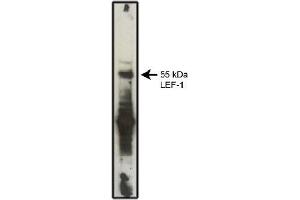Western Blotting (WB) image for anti-Lymphoid Enhancer-Binding Factor 1 (LEF1) antibody (ABIN264379) (LEF1 抗体)