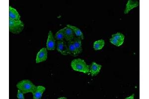 Immunofluorescence staining of HepG2 cells with ABIN7158609 at 1:200, counter-stained with DAPI. (LYVE1 抗体  (AA 20-238))