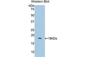 Detection of Recombinant ANXA2, Human using Polyclonal Antibody to Annexin A2 (ANXA2) (Annexin A2 抗体  (AA 1-339))