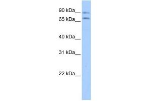 Junctophilin 2 antibody used at 1 ug/ml to detect target protein. (Junctophilin 2 抗体  (Middle Region))