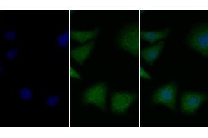 Detection of BDNF in Human Hela cell using Polyclonal Antibody to Brain Derived Neurotrophic Factor (BDNF) (BDNF 抗体  (AA 139-249))