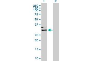 Western Blot analysis of HPX expression in transfected 293T cell line by HPX MaxPab polyclonal antibody. (Hemopexin 抗体  (AA 1-254))
