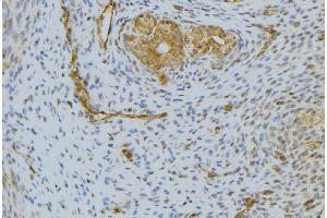 ABIN6276594 at 1/100 staining Human uterus tissue by IHC-P. (HGF 抗体  (Internal Region))