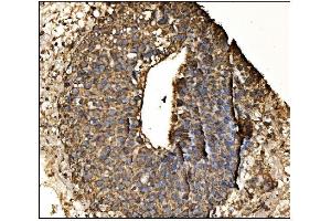 IHC analysis of Arginine Decarboxylase/AZIN2 using anti-Arginine Decarboxylase/AZIN2 antibody (ABIN7599403). (ADC 抗体  (AA 1-448))