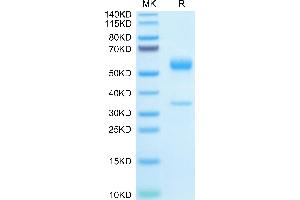 SDS-PAGE (SDS) image for Placenta Growth Factor (PGF) (AA 19-158) protein (Fc Tag) (ABIN7275448)