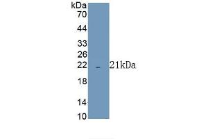 Detection of Recombinant COX4I1, Human using Polyclonal Antibody to Cytochrome C Oxidase Subunit IV Isoform 1 (COX4I1) (COX IV 抗体  (AA 1-169))